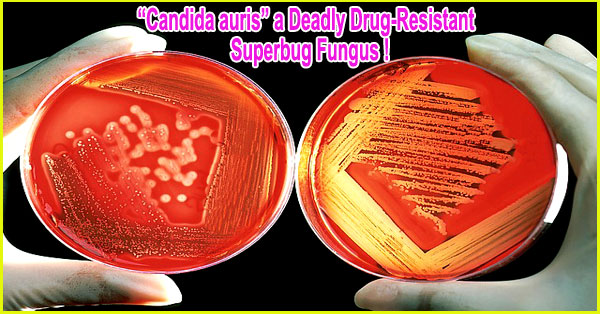 Candida auris a deadly drug-resistant super-bug fungus